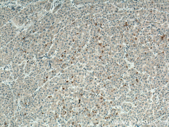 BCRP/ABCG2 Antibody in Immunohistochemistry (Paraffin) (IHC (P))