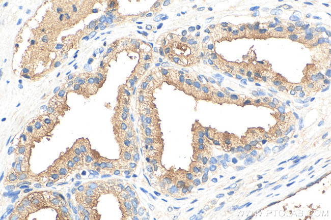 NRG4 Antibody in Immunohistochemistry (Paraffin) (IHC (P))