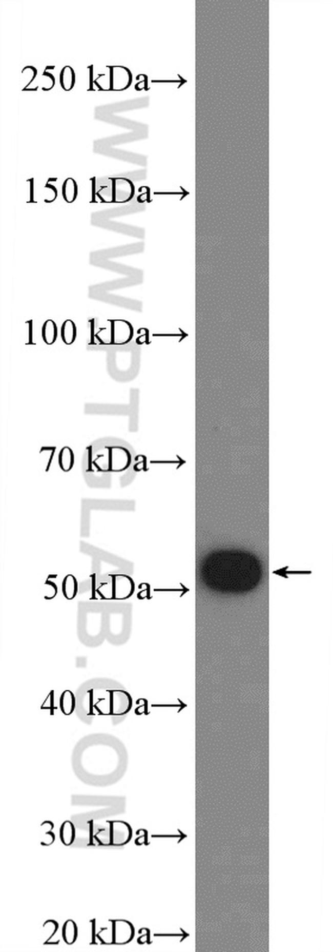 FBXO31 Antibody in Western Blot (WB)