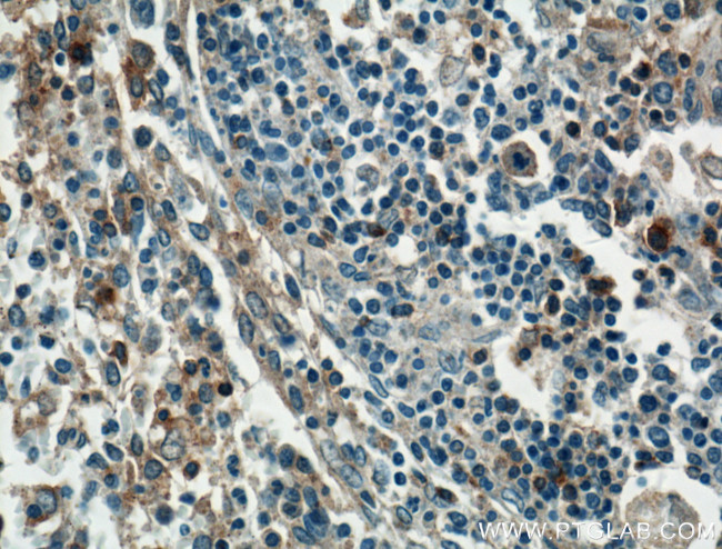 GBP2 Antibody in Immunohistochemistry (Paraffin) (IHC (P))