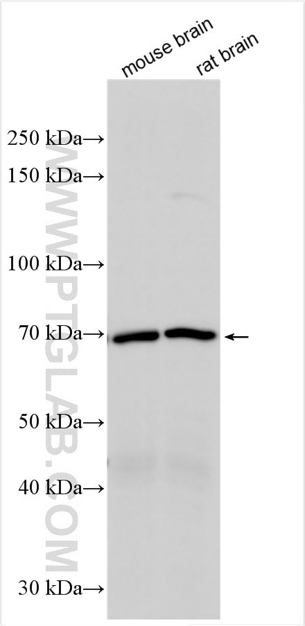 VAChT Antibody in Western Blot (WB)