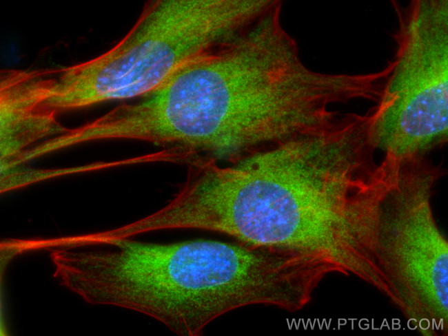 SERCA2, ATP2A2 Antibody in Immunocytochemistry (ICC/IF)