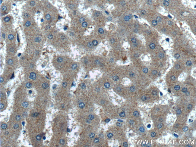 STAMBPL1 Antibody in Immunohistochemistry (Paraffin) (IHC (P))