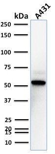 TOX3/TNRC9 Antibody in Western Blot (WB)