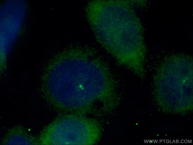 CEP170 Antibody in Immunocytochemistry (ICC/IF)