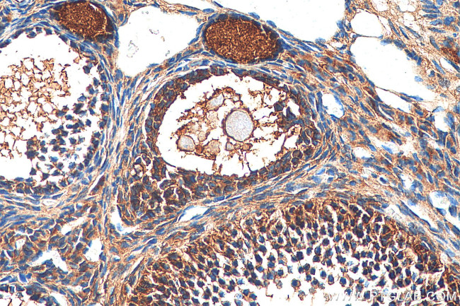 Inhibin alpha Antibody in Immunohistochemistry (Paraffin) (IHC (P))