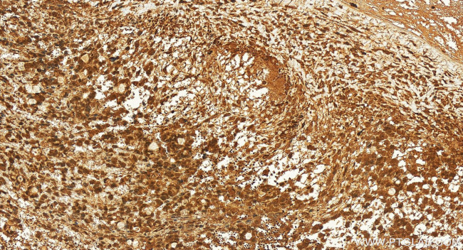 HEATR3 Antibody in Immunohistochemistry (Paraffin) (IHC (P))