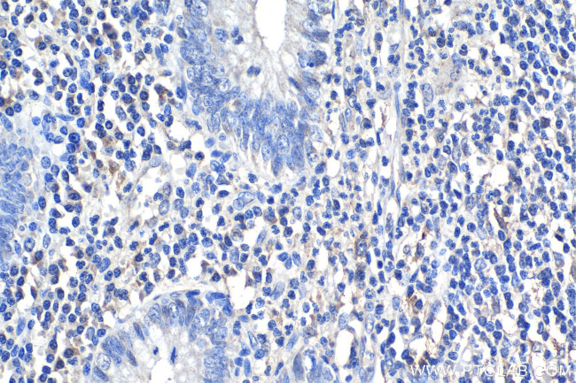 IL-1R1 Antibody in Immunohistochemistry (Paraffin) (IHC (P))