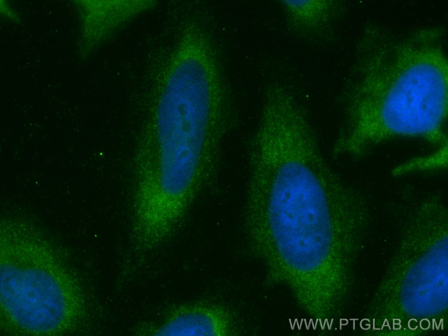 Follistatin Antibody in Immunocytochemistry (ICC/IF)