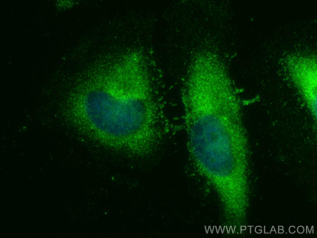 ULK1 Antibody in Immunocytochemistry (ICC/IF)