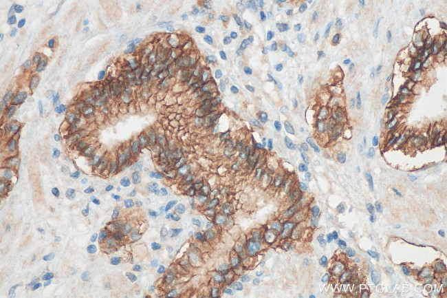 TACSTD2/TROP2 Antibody in Immunohistochemistry (Paraffin) (IHC (P))