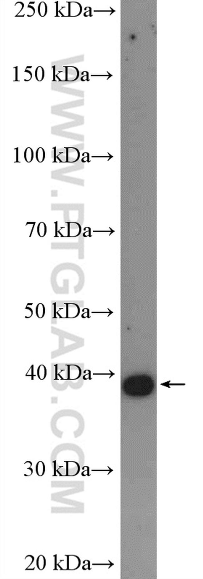 CYSLTR1 Antibody in Western Blot (WB)