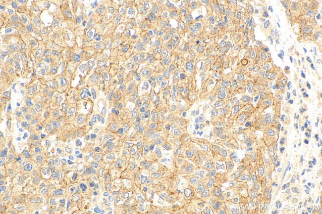 C19orf12 Antibody in Immunohistochemistry (Paraffin) (IHC (P))
