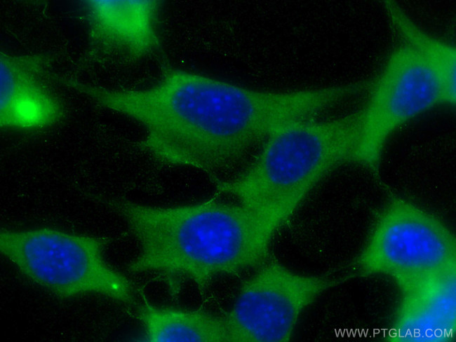 PDCD1LG2/PD-L2 Antibody in Immunocytochemistry (ICC/IF)