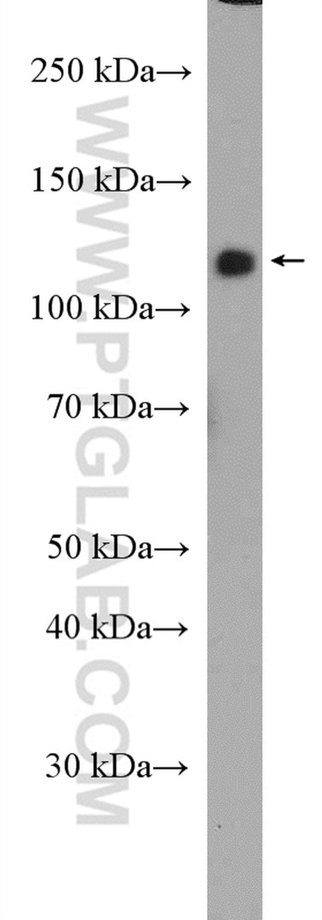 CNTNAP3 Antibody in Western Blot (WB)