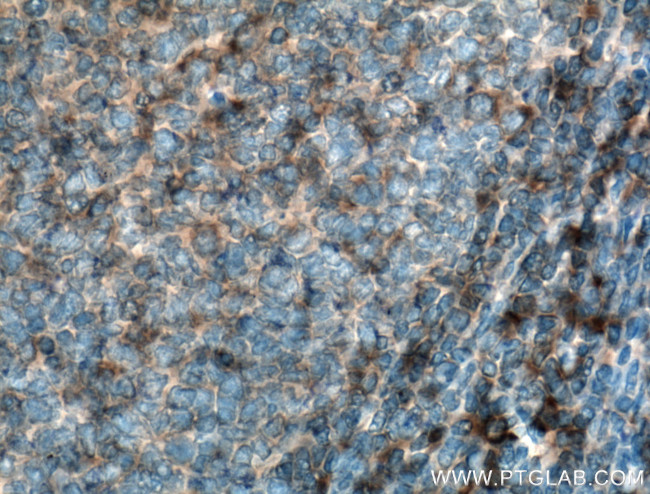 HLA-E Antibody in Immunohistochemistry (Paraffin) (IHC (P))
