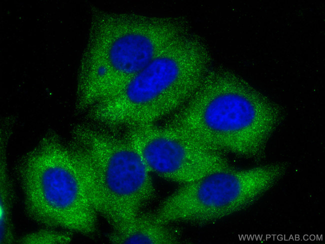 BMX Antibody in Immunocytochemistry (ICC/IF)