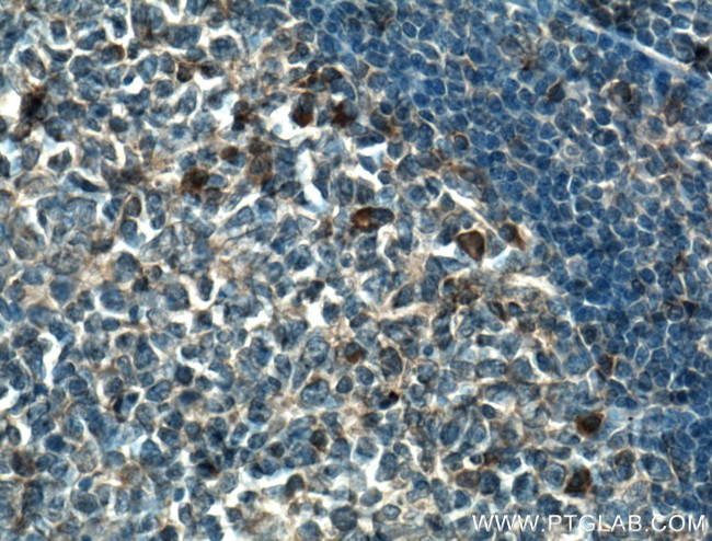 TSEPA Antibody in Immunohistochemistry (Paraffin) (IHC (P))