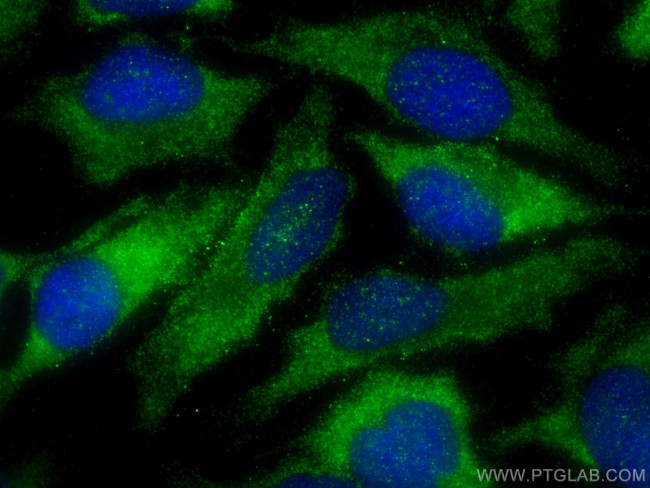 TXNIP Antibody in Immunocytochemistry (ICC/IF)