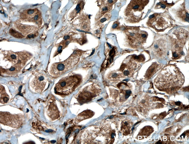 BRAP Antibody in Immunohistochemistry (Paraffin) (IHC (P))
