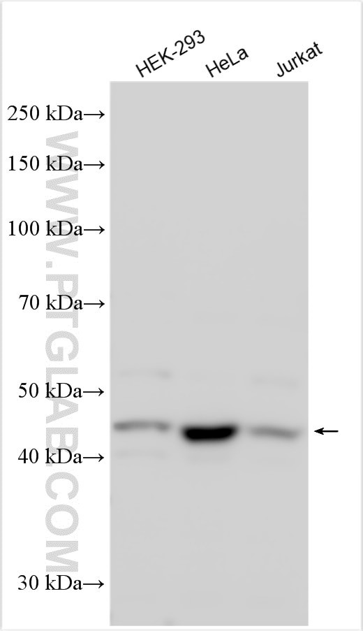 TUBD1 Antibody in Western Blot (WB)