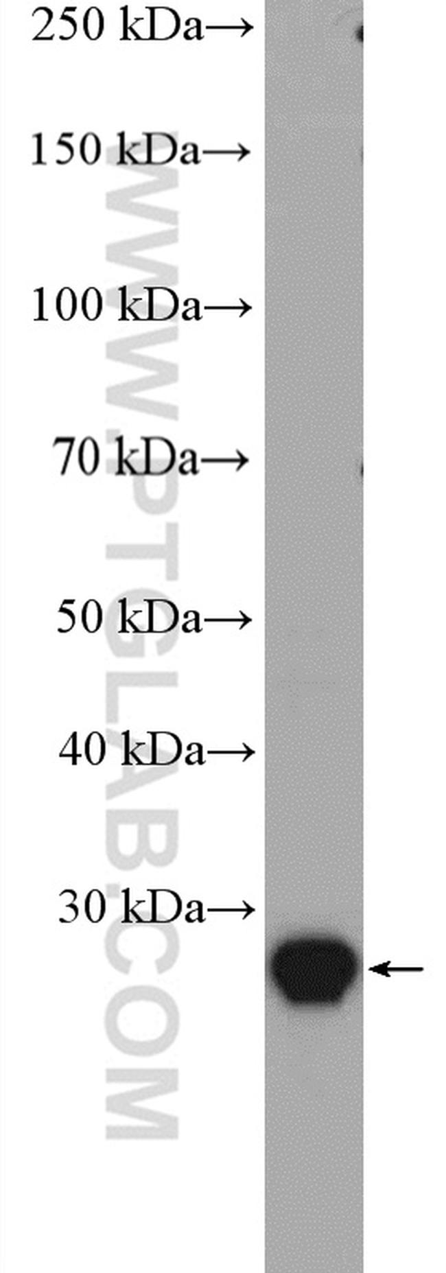 RAB34 Antibody in Western Blot (WB)