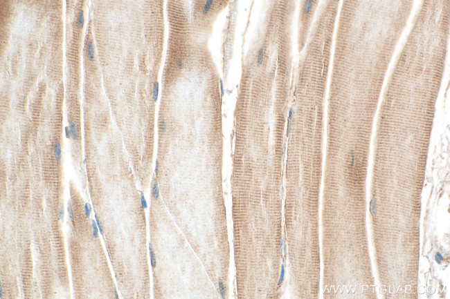 SULF1 Antibody in Immunohistochemistry (Paraffin) (IHC (P))