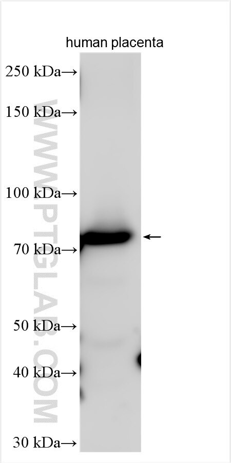 EPB42 Antibody in Western Blot (WB)