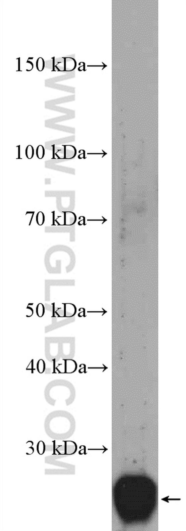 C21orf70 Antibody in Western Blot (WB)