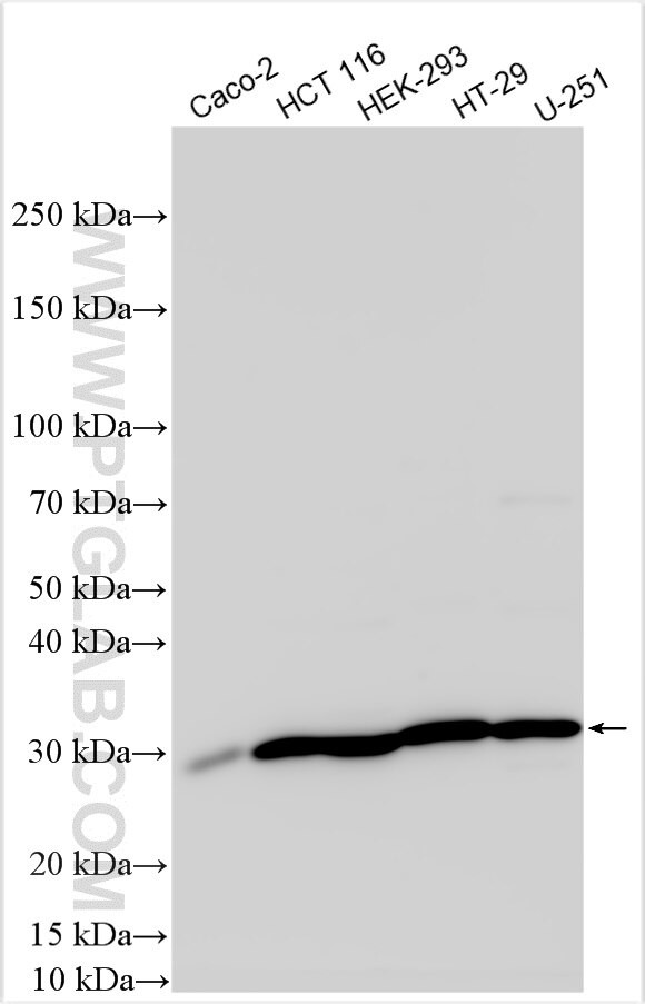 ABCA3 Antibody in Western Blot (WB)