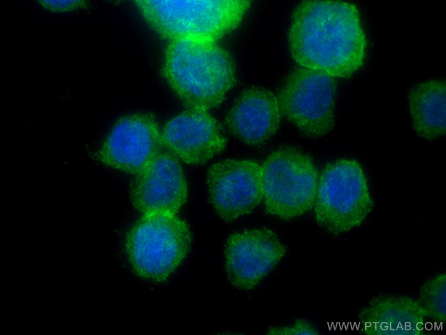 PLCB2 Antibody in Immunocytochemistry (ICC/IF)