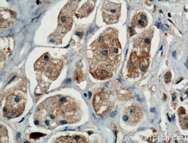 TRIM8 Antibody in Immunohistochemistry (Paraffin) (IHC (P))