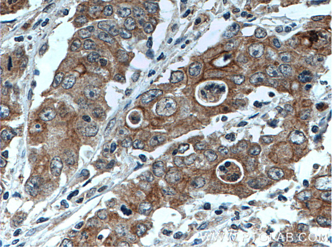 ATG4A Antibody in Immunohistochemistry (Paraffin) (IHC (P))