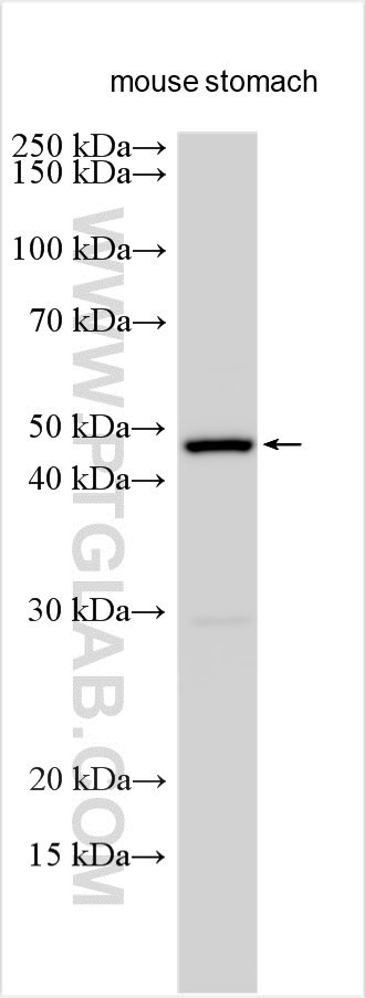 KIFC2 Antibody in Western Blot (WB)