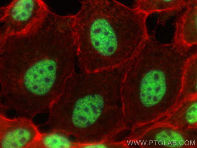 C1orf77 Antibody in Immunocytochemistry (ICC/IF)