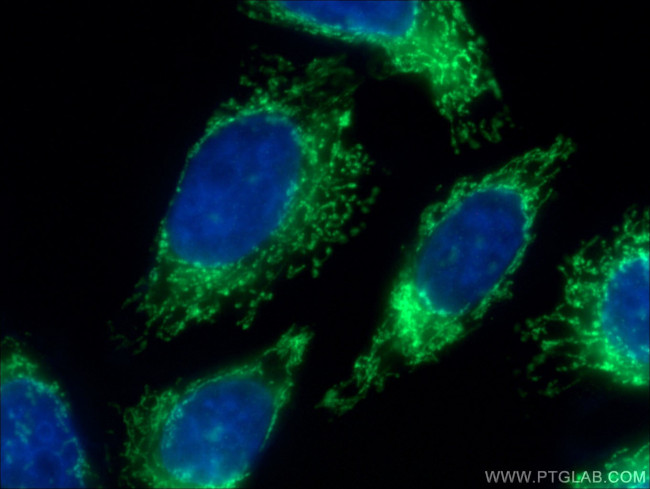 MRPL4 Antibody in Immunocytochemistry (ICC/IF)