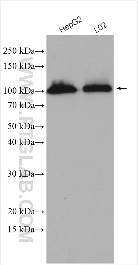 DHTKD1 Antibody in Western Blot (WB)