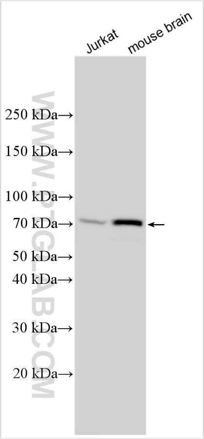 CLUL1 Antibody in Western Blot (WB)
