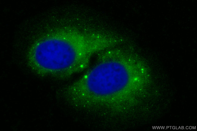 PSMD8 Antibody in Immunocytochemistry (ICC/IF)