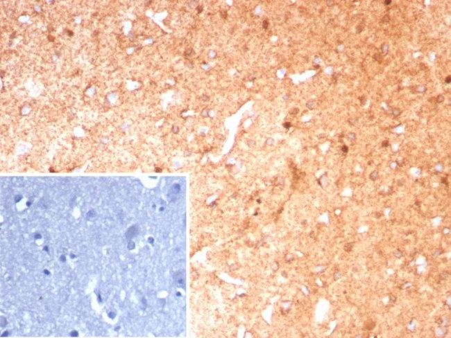 Glutamine Synthetase/GLUL Antibody in Immunohistochemistry (Paraffin) (IHC (P))