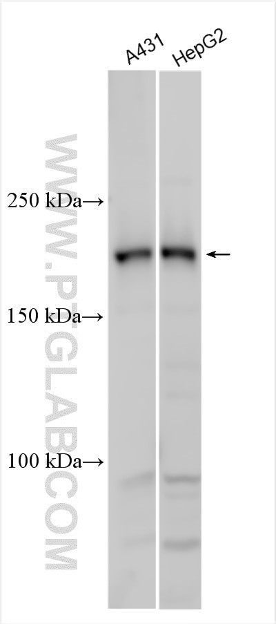 Supervillin Antibody in Western Blot (WB)