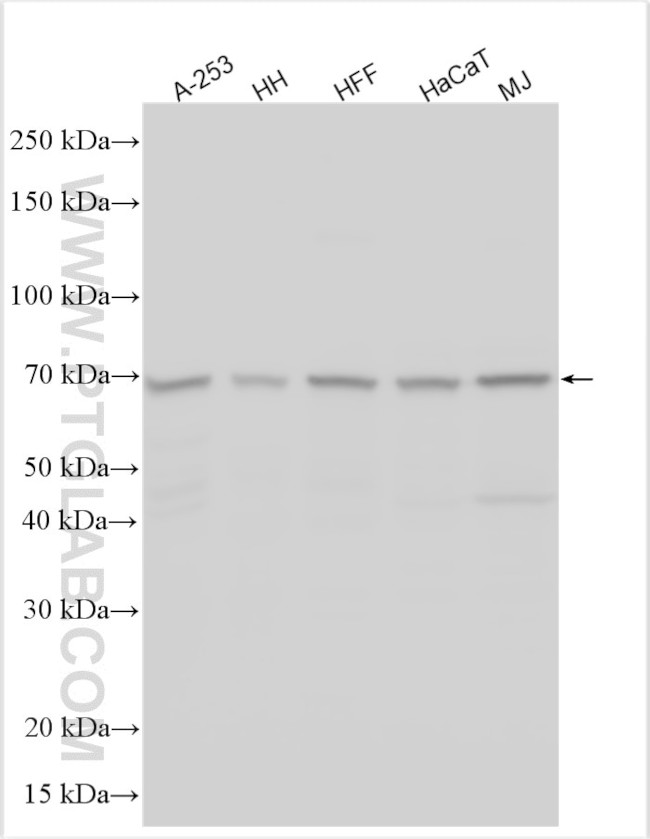 TMEM45A Antibody in Western Blot (WB)