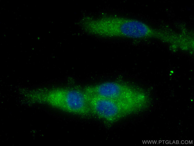 CTSS Antibody in Immunocytochemistry (ICC/IF)