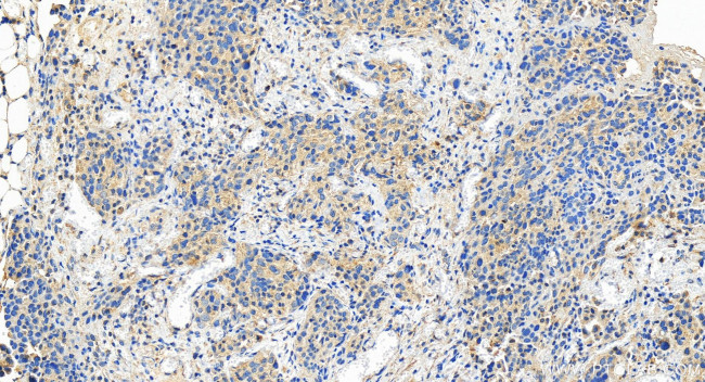 ECSIT Antibody in Immunohistochemistry (Paraffin) (IHC (P))