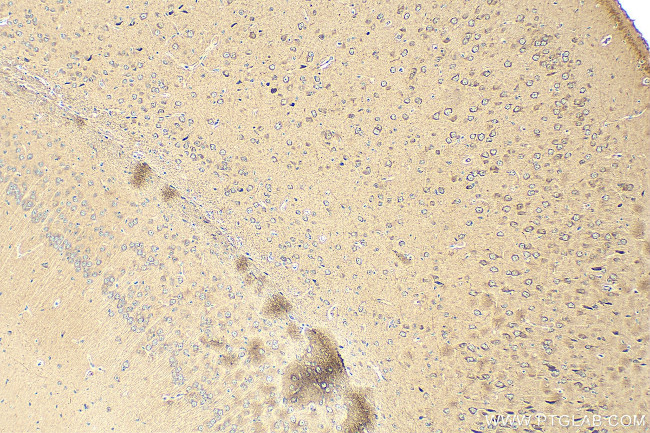 TRAPPC10 Antibody in Immunohistochemistry (Paraffin) (IHC (P))