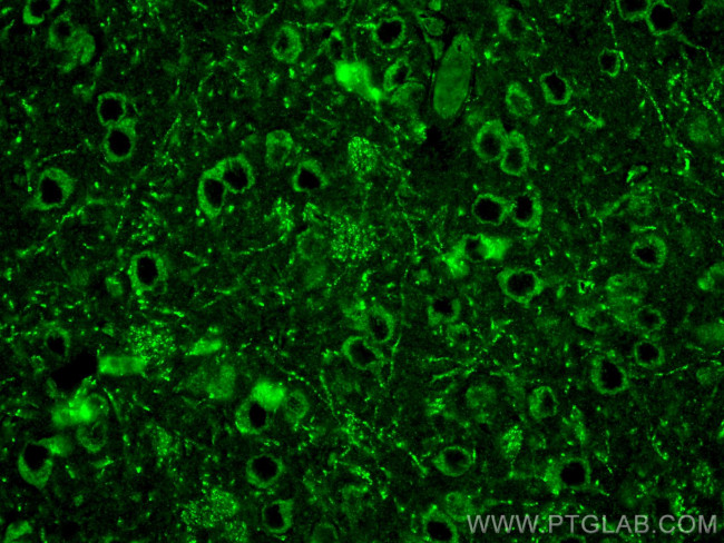 SCN2A Antibody in Immunohistochemistry (PFA fixed) (IHC (PFA))
