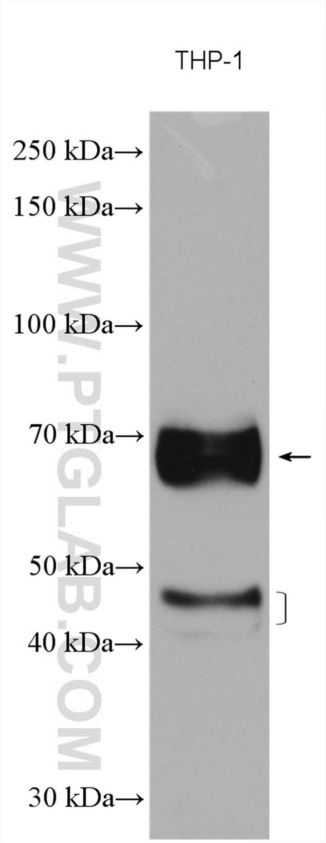 CD64 Antibody in Western Blot (WB)
