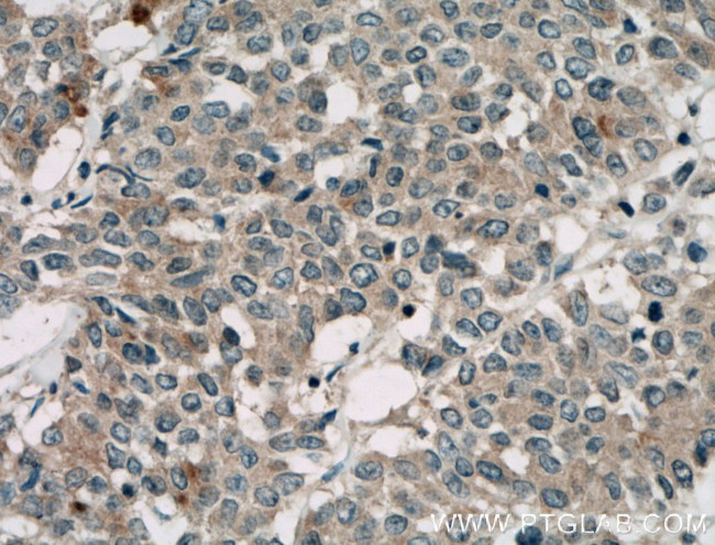 TAB1 Antibody in Immunohistochemistry (Paraffin) (IHC (P))