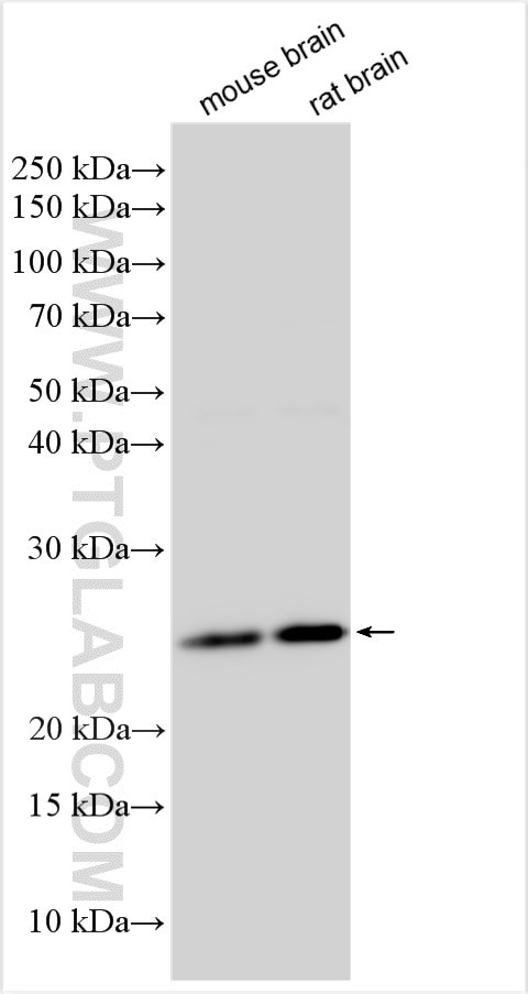 ANKRD46 Antibody in Western Blot (WB)