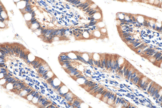 SLC6A19 Antibody in Immunohistochemistry (Paraffin) (IHC (P))